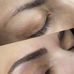 هدا ایزدی ؛ میکرو تخصصی صورت اصفهان