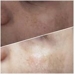 فیشیال / خدمات پوست / سالن زیبایی