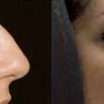 کلینیک زیبایی الماس کاملا اقساطی
