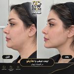 مرکز پی آر پی تهران