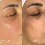 کلینیک تخصصی پوست ،مو،لیزر رزسفید