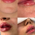 مطب پوست و مو و لیزر ژیوان