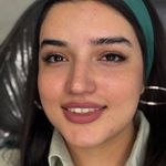 مرکز زیبایی عاطفه ترابی؛ فیبروز ابرو در اصفهان