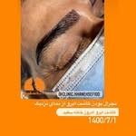 کلینیک کاشت مو خانه سفید