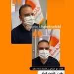 کلینیک کاشت مو خانه سفید