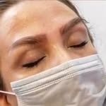 کلینیک کاشت مو خانه سفید