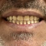 دندانسازی داود یارمحمدی