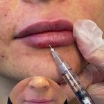 کلینیک زیبایی فریحا(پوست و مو)