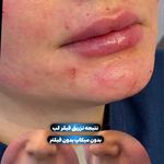 کلینیک زیبایی فریحا(پوست و مو)