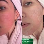 خدمات فیشیال و پاکسازی پوست