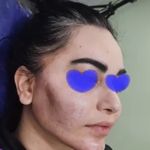 کلینیک زیبایی الماس کاملا اقساطی