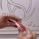 لابراتواردندانسازی ملیکااسماعیلی