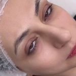 مرکز تخصصی فیبرز ابر‌و حمیده رحیمی
