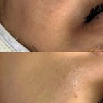 مژگان اسکین کرMojgan skincare