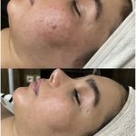 پاکسازی پوست و مو مهسام