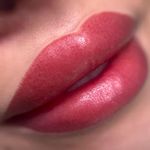 خدمات تخصصی میکرو و ریموو صدف