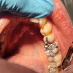 مطب دندانپزشکی سورنا (دکتر سروش هاشمی)