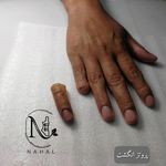 کلینیک ارتوپدی فنی نهال