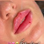 کلینیک زیبایی شایلی