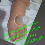 حجامت تخصصی کل بدن اکبرکریمی سیار(منزل)