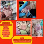 کلینیک زخم شکیبی