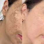خدمات تخصصی فیشال و پاکسازی