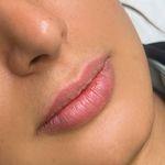 کلینیک زیبایی لیلاک