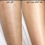 مرکز لیزر روز دنیا