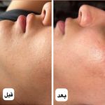 فیشال تخصصی_درمان پوست  دنا ساحل