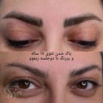 خدمات میکروبلیدینگ در اندیشه