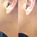 آموزش و خدمات پوست و فیشال رویا باقریان