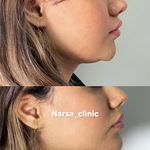 کلینیک پوست مو زیبایی فیلر بوتاکس نارسا