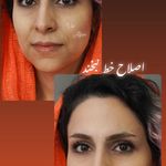 کلینیک زیبایی پوست و لیزر آلن