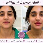 کلینیک تخصصی ژل و بوتاکس مرضیه آقابابایی