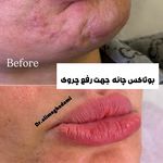 دکتر علی مقدمی (پزشک پوست مو زیبایی)