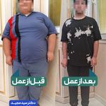 دکتر سادات منصوری جراح متخصص چاقی