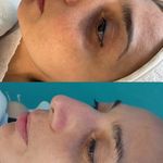 کلینیک لیزر  کندلاوزیبایی پوست ومو آیشیل