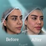 مطب پوست زيبايی ليزر دکتر شاه نعمت الهی