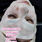 مژگان اسکین کرMojgan skincare