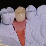 دندانسازی ابراهیمی