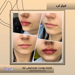 مطب پوست مو زیبایی فردوس شرق