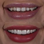 دندانپزشکی میلانا