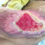 مرکز تخصصی درمان زخم تندیس تندرستی