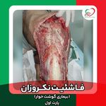 مرکز تخصصی درمان زخم تندیس تندرستی