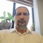 کلینیک کاشت موی ایران نوین