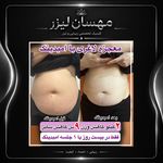 کلینیک لیزر و زیبایی مهسان