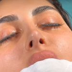 کلینیک زیبایی الماس کاملا اقساطی