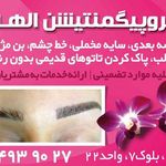 میکرو پیگمنتیشن الهه ناز