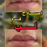 مجموعه زیبایی لاریسا - سمنان - 9663