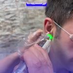 مرکز لیزر موهای زائد نور